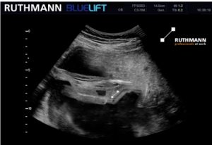 noticias-maquinaria-RUTHMANN-apex