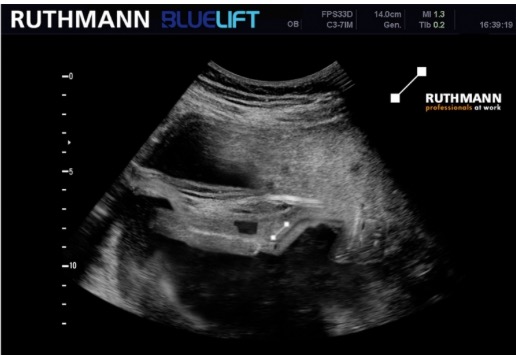 noticias-maquinaria-RUTHMANN-apex